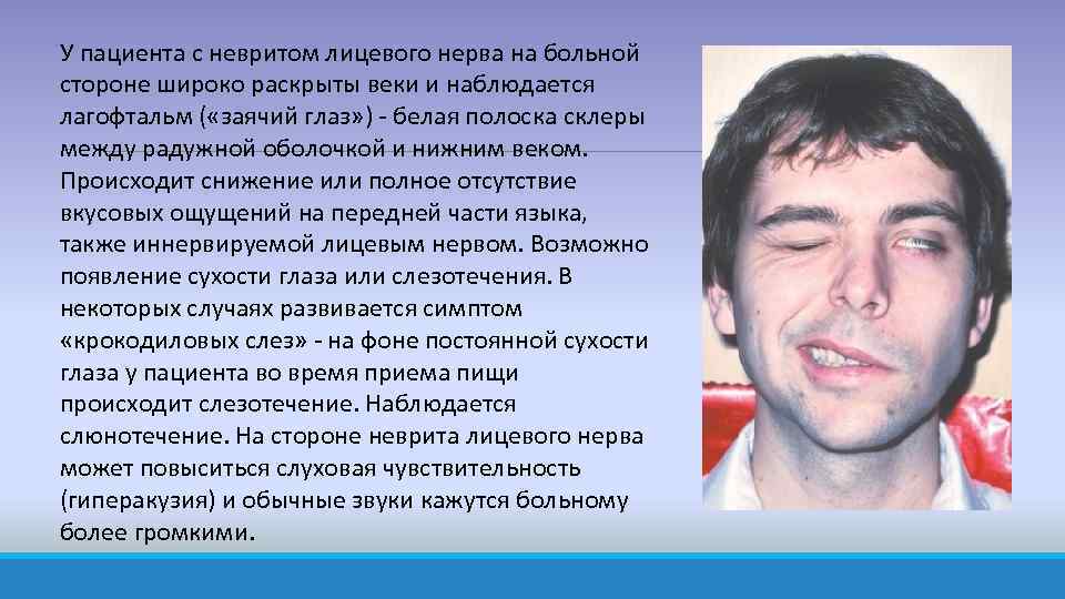 Нарушение речи у взрослых