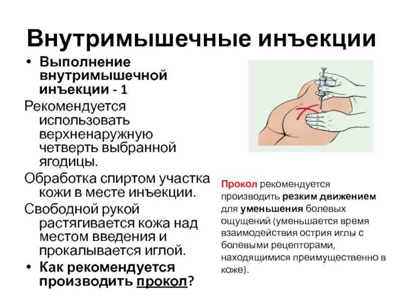 Для чего назначают внутримышечно. Порядок проведения инъекции. Внутримышечная инъекция алгоритм. Внутримышечная инъекция максимальный объем раствора. Препарат для обработка места инъекции.