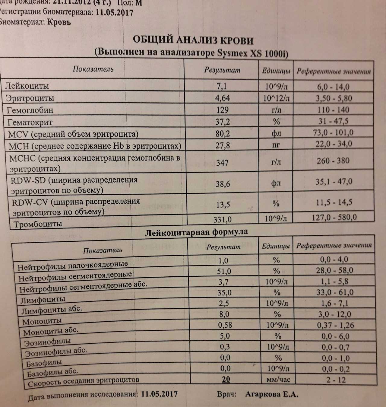 Гемолитическая анемия