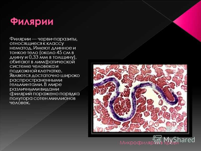 Трихоцефалез — симптомы, диагностика и лечение при заражении власоглавом