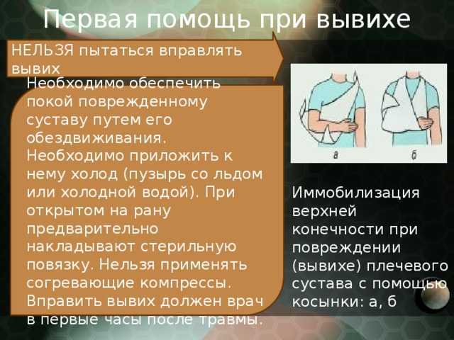 Лечение вывихов, растяжений, разрывов связок