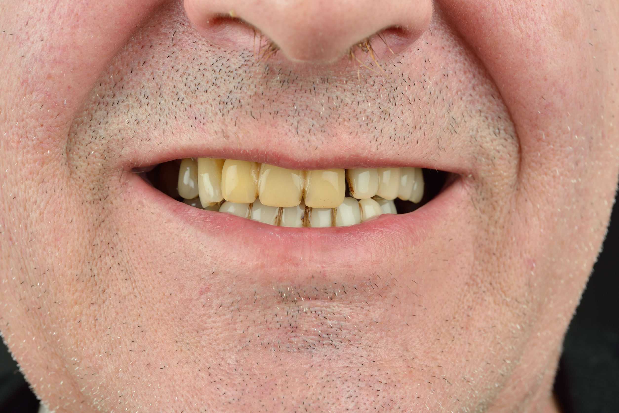 К чему снятся гнилые зубы, вырывать зубы во сне? основные толкования - к чему снятся гнилые зубы мужчине или женщине - автор екатерина данилова - журнал женское мнение