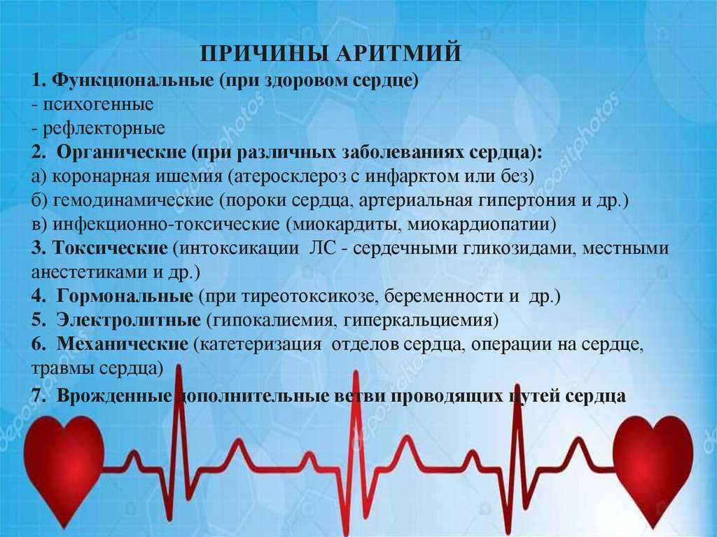Мерцательная аритмия сердца