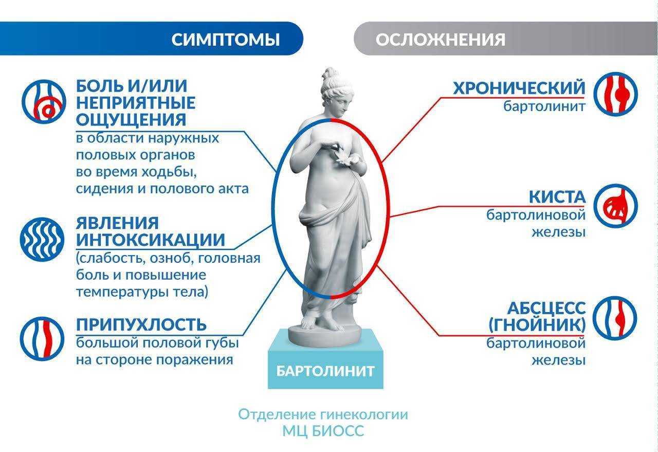 Воспаление бартолиновой. Признаки воспаления бартолиновой железы. Бартолинит осложнения. Воспаление бартолиновых желез симптомы.