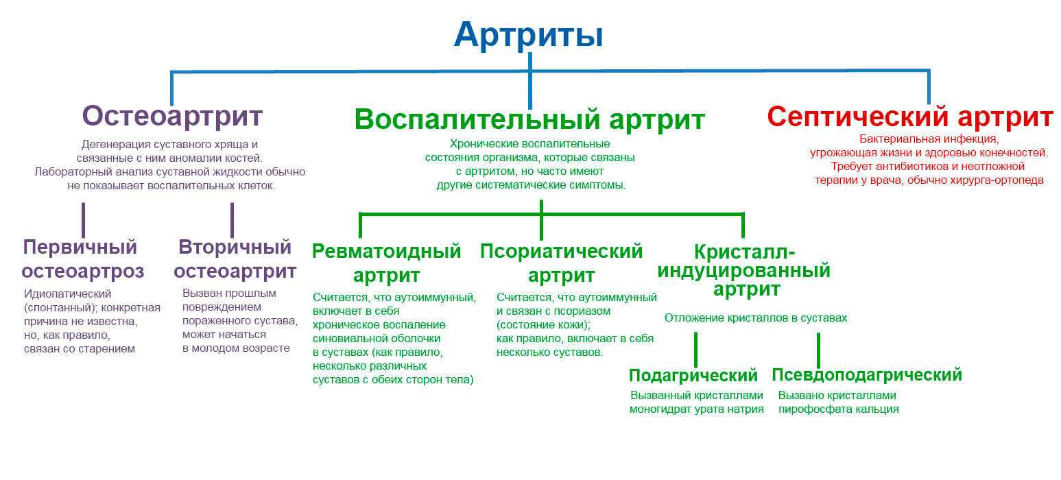 Артрит схема лечения