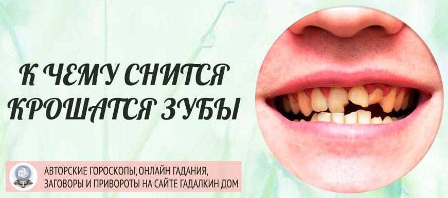 Выпадение зубов без крови