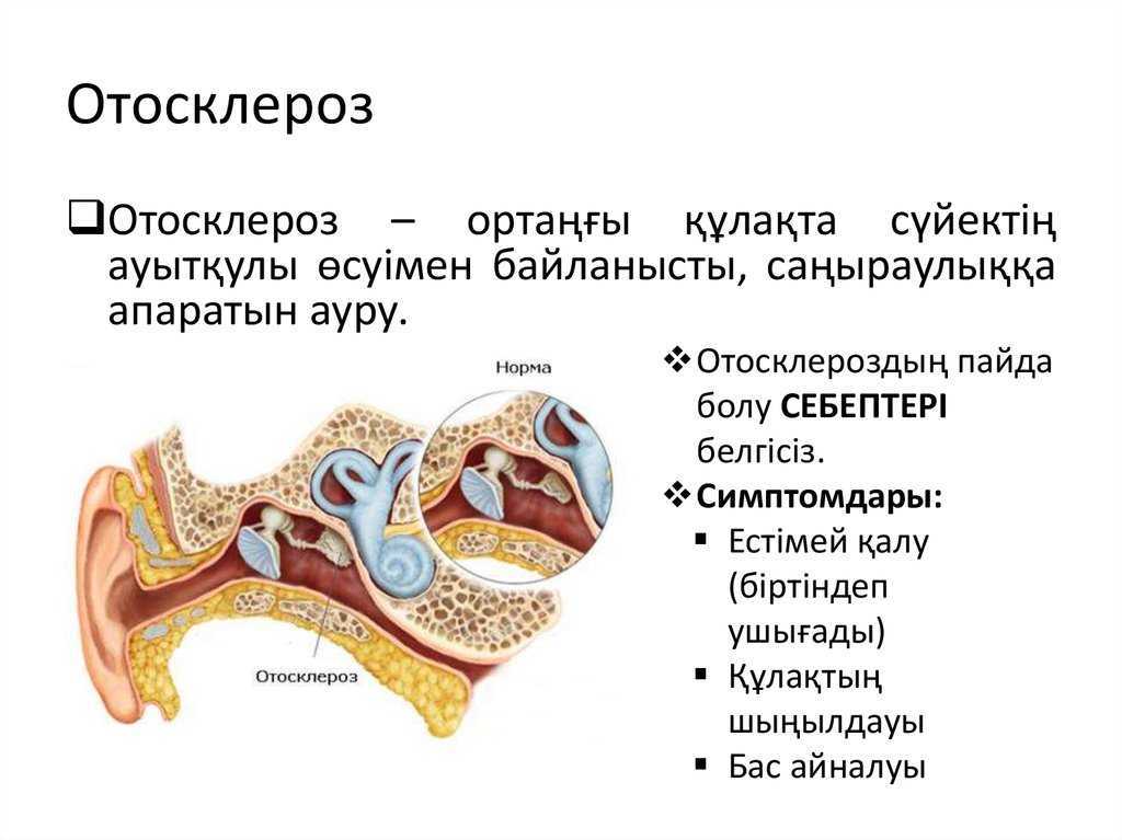Энцефалопатия