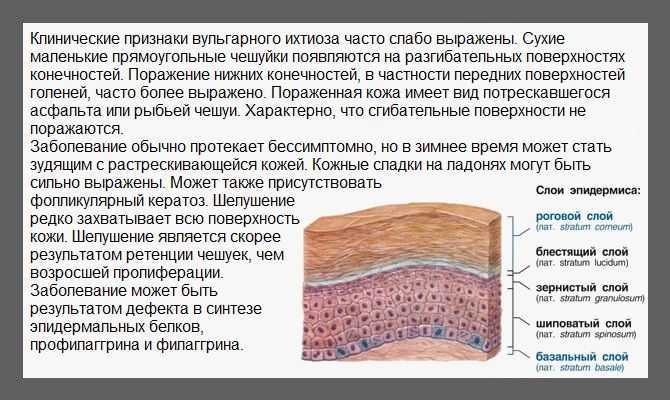 Подошвенная бородавка или сухая мозоль: главные признаки различия и методы лечения.