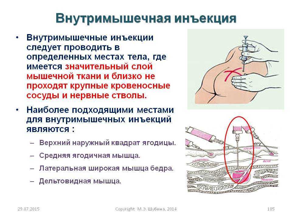 На сколько нужно вводить иглу при уколе в ягодицу взрослому фото