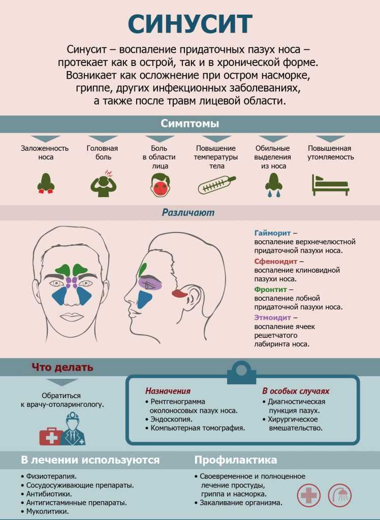 Болят пазухи носа: причины и способы лечения