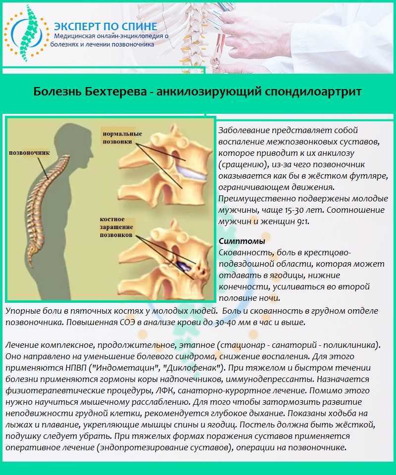 Лечение болезни бехтерева препараты схема лечения