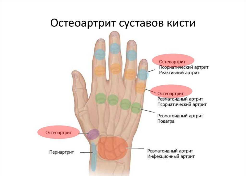 Полинейропатия ️: симптомы, признаки и причины, диагностика и лечение