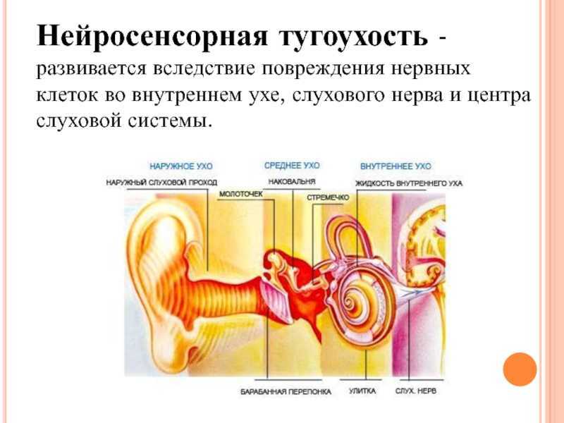 Симптомы тугоухости. нейросенсорная тугоухость симптомы и лечение.