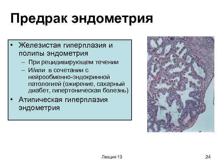Аденомиоз матки: что за диагноз, симптомы у женщин разного возраста, причины возникновения, лечение