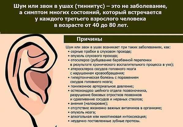 Звон в ушах - причины и лечение | почему постоянно звенит в левом, правом ухе, что делать?