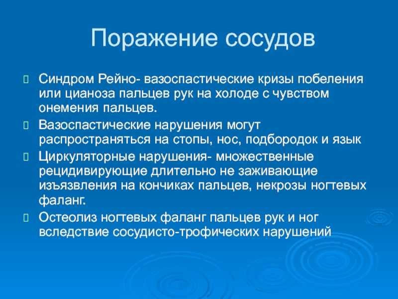 Синдром рейно что это такое простыми