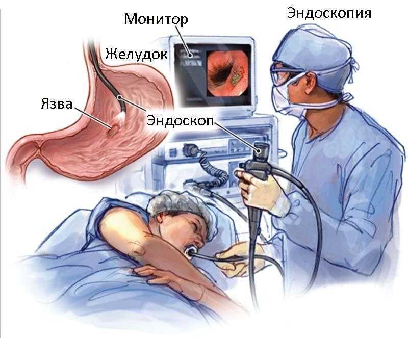 Эндоскопия - исследование полых органов без операции