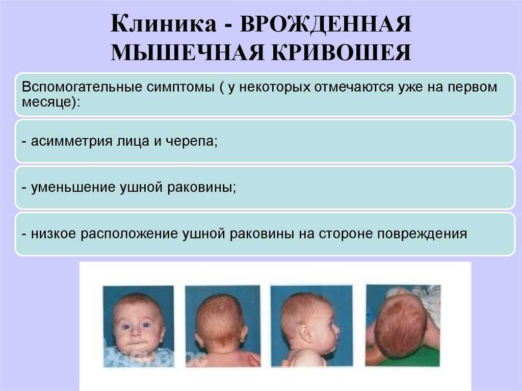 Наиболее частые генетические дефекты у детей | аборт в спб