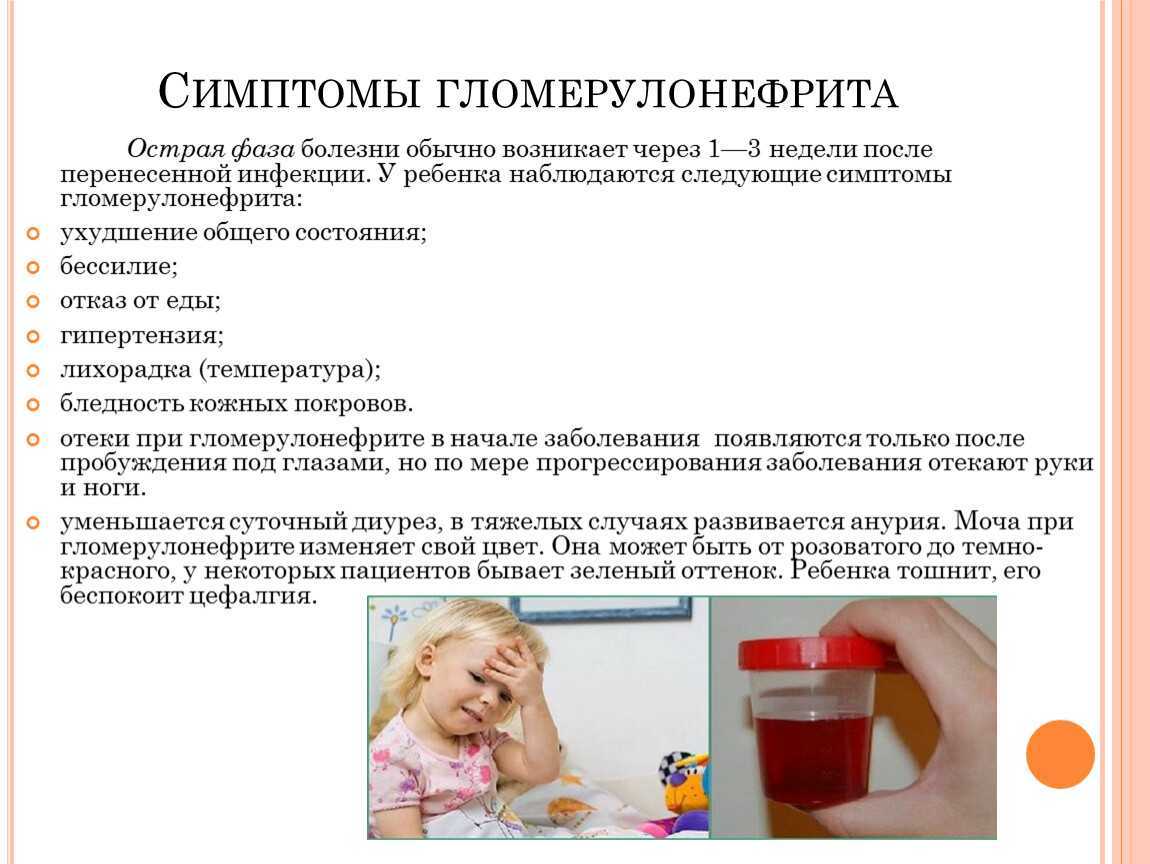 Гемодиализ