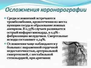 Коронарография сердца: что это такое, показания, как проходит процедура