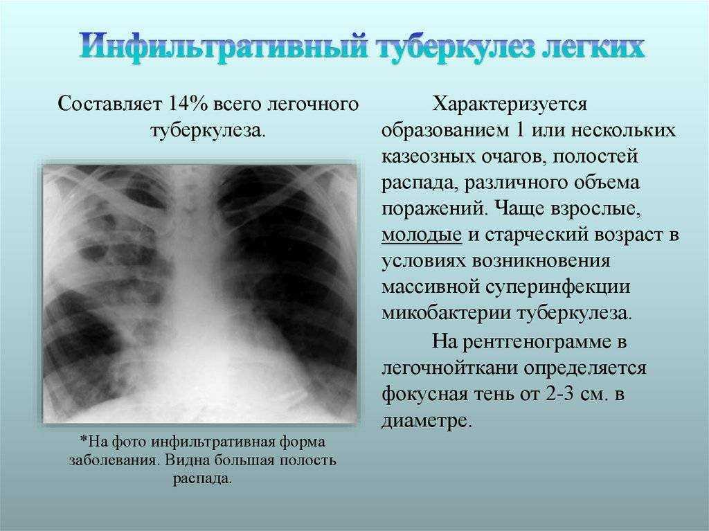 Рентген пазух носа: особенности исследования