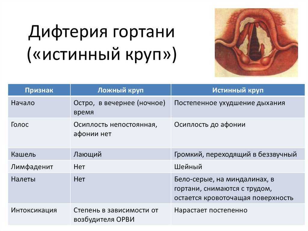 План лечения дифтерии