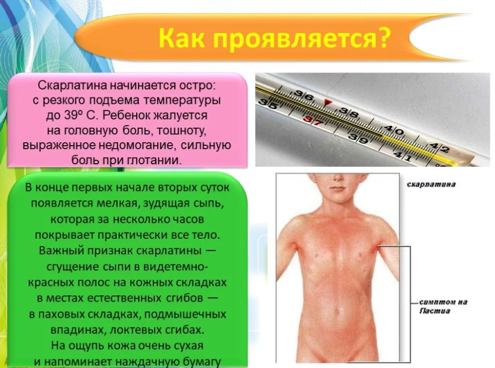 Скарлатина: проявления заболевания, осложнения у взрослых и лечение