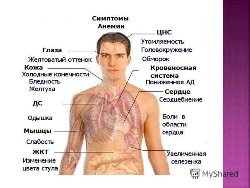 Анемия кислород