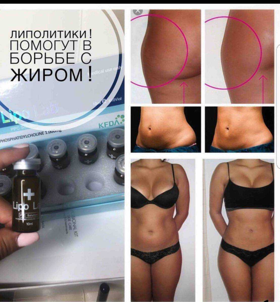 Миостимуляция тела и мышц живота для похудения: польза аппарата для миостимуляции и возможные противопоказания