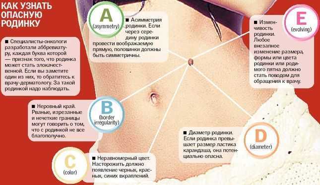 Новообразования на коже