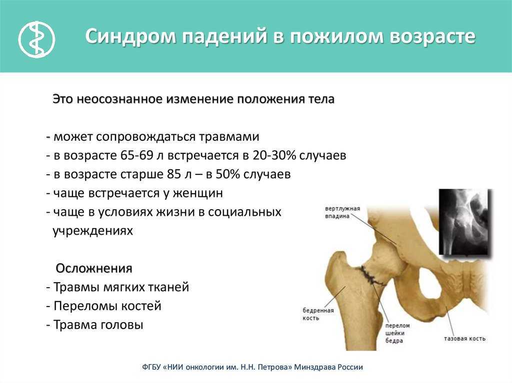 Где находится шейка бедра у женщины фото симптомы и лечение