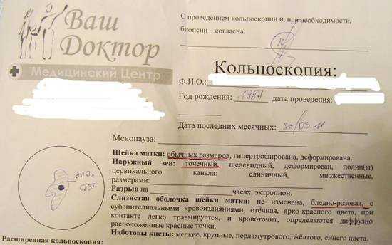 Кольпоскопия