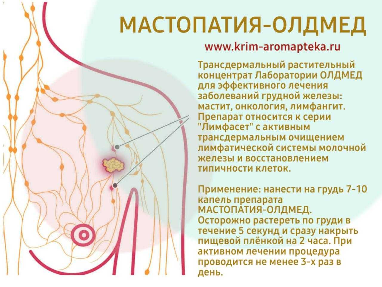 Проявление фиброзной мастопатии