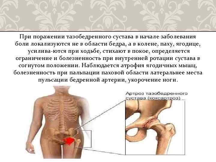 Боль в паху операции. Болит в области тазобедренного сустава. Боль в тазобедренном суставе спереди. Локализация боли при воспалении тазобедренного сустава. Болит левый тазобедренный сустав.