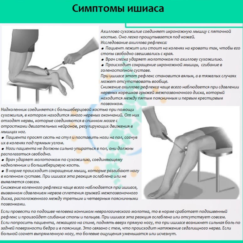 Схема лечения ишиаса уколы