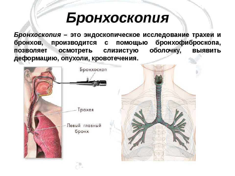 Лечебная бронхоскопия. Инструментальный метод исследования бронхоскопии. Бронхоскопия эндоскопическое исследование бронхов. Эндоскопическое исследование трахеи.