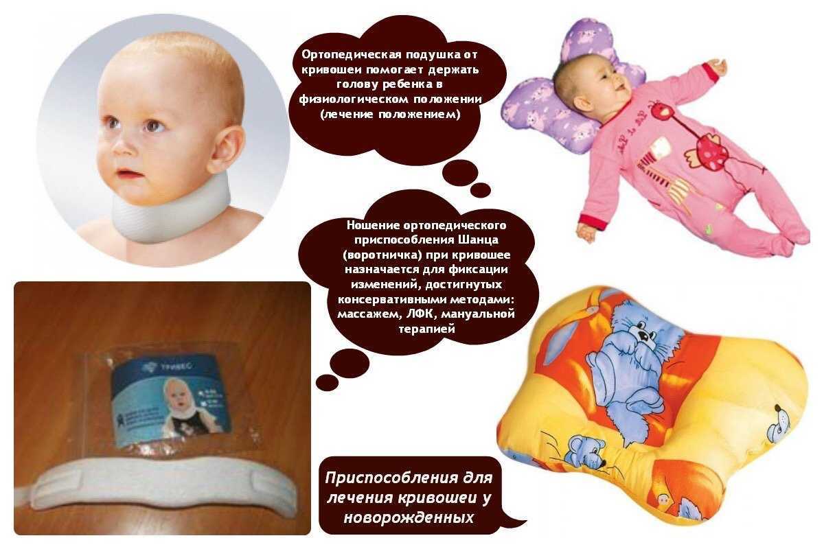 Кривошея у ребёнка