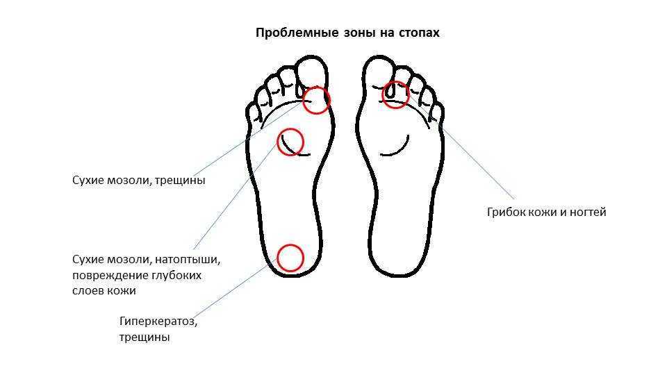 Болезни стопы человека в картинках и название и лечение