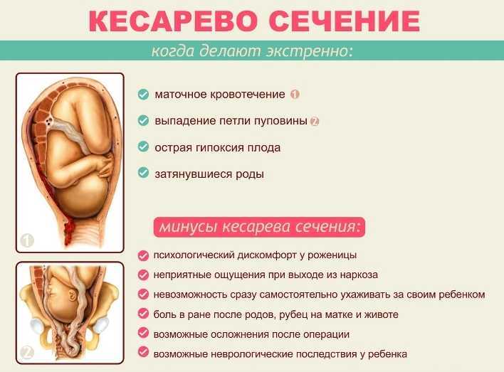 Живот после кесарева сечения: советы по восстановлению, методы подтяжки обвисшего живота после родов  | блог expert clinics