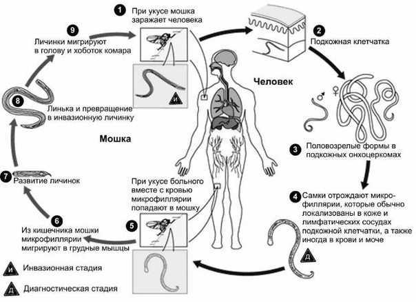 Филярии: жизненный цикл червей, описание, симптомы и пути заражения (фото и видео) | признаки, лечение и диагностика вгкб № 2