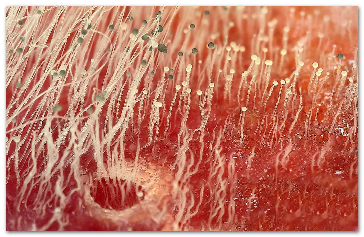 Грибы споры в организме. Грибы кожи под микроскопом. Кожные заболевания под микроскопом. Грибок кожи под микроскопом.