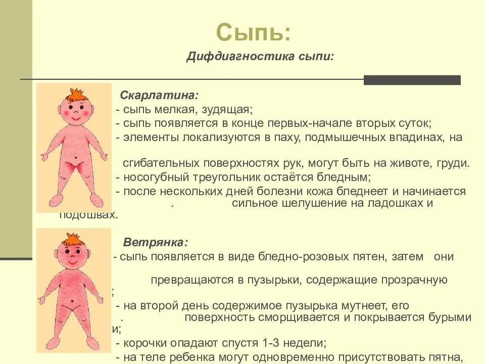 Скарлатина у детей, взрослых: симптомы, лечение, профилактика +фото - напоправку – напоправку