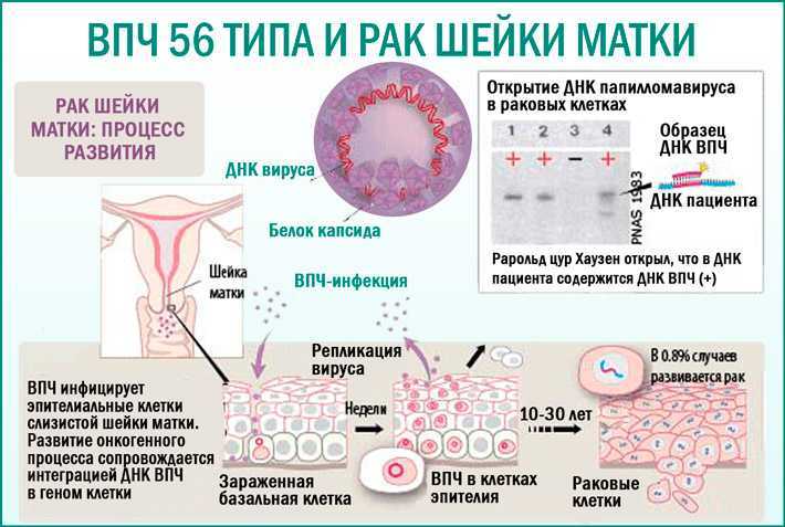 Лечение вируса папилломы человека у детей и взрослых: удаление бородавок на лице, руках и теле