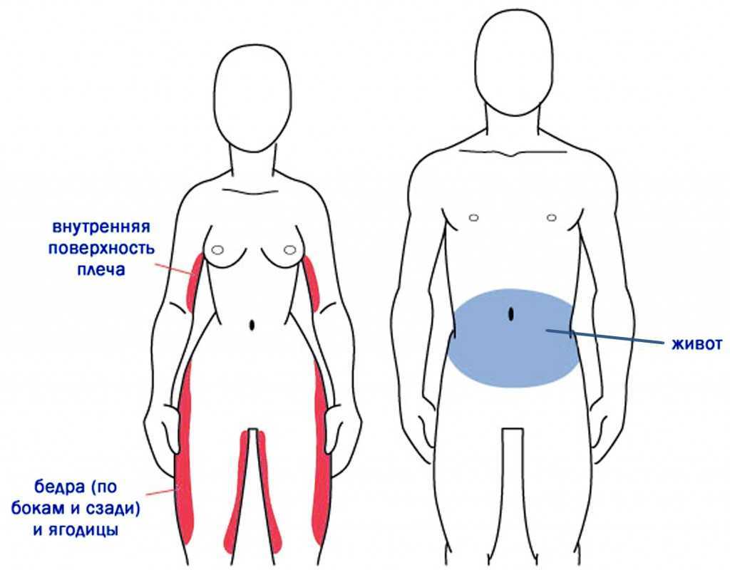 Карта жировых отложений