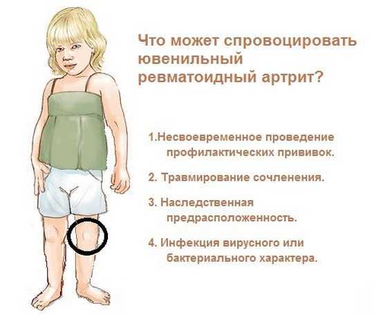Боль в голеностопе – причины, симптомы, диагностика и лечение