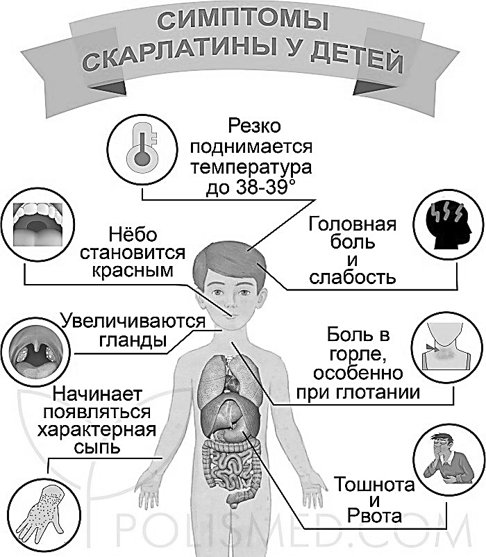 Скарлатина у детей – этапы болезни, классификация видов, протекание заболевания | см-клиника