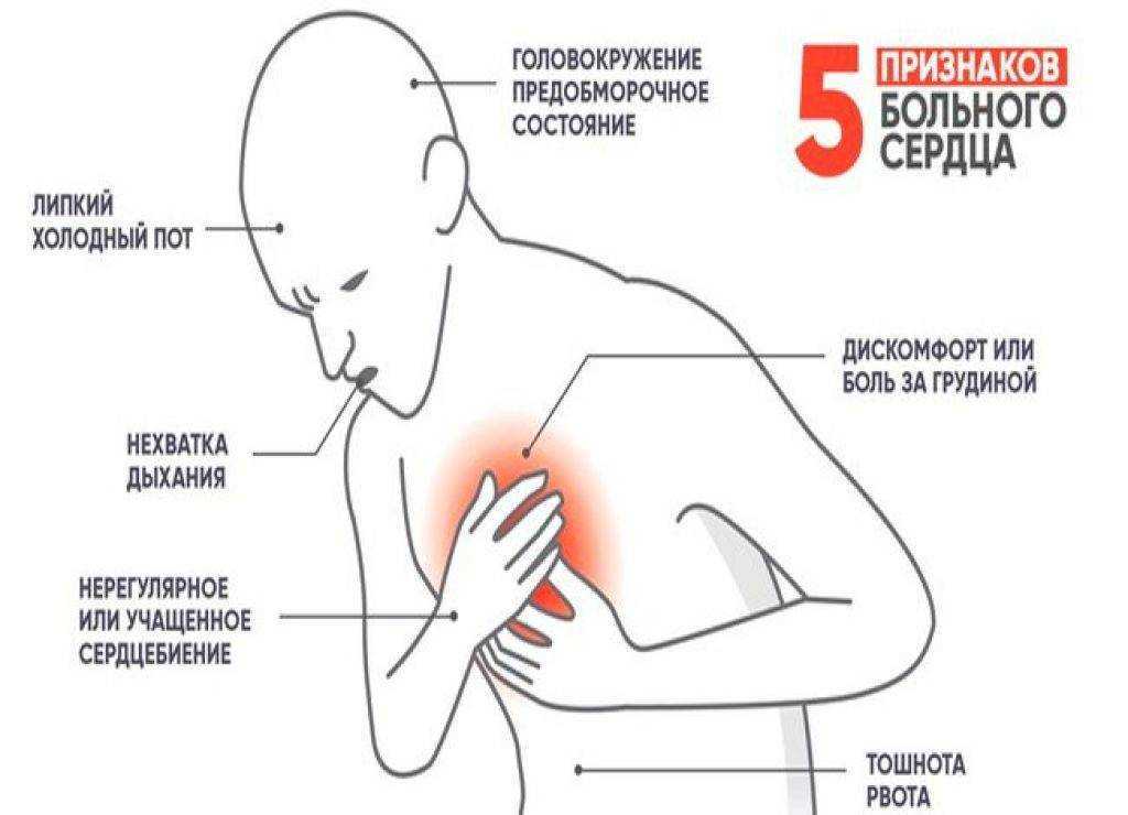 Презентация боли в сердце