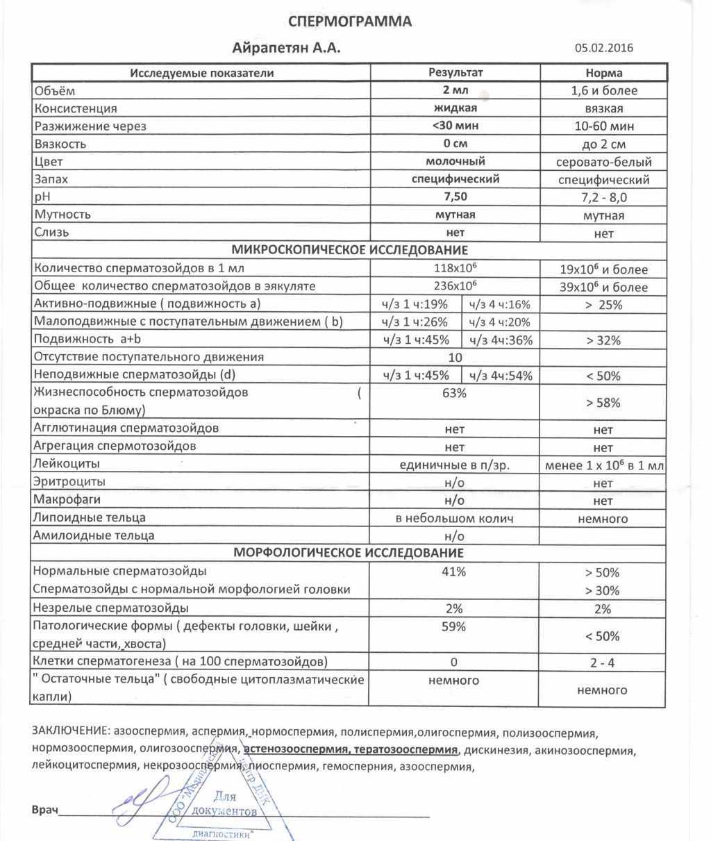 Расшифровка спермограммы