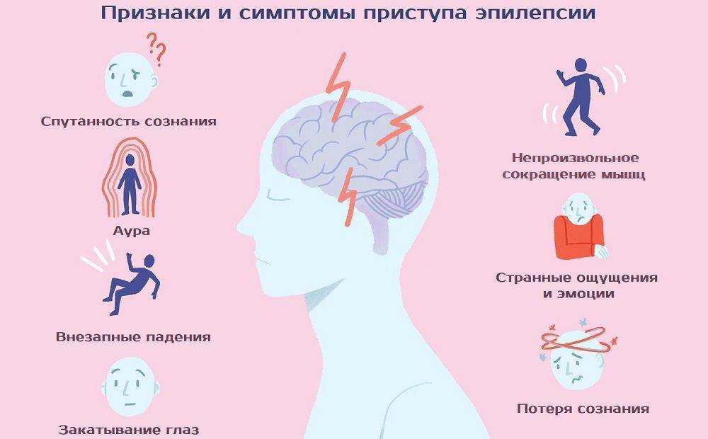 Лечение эпилепсии картинки