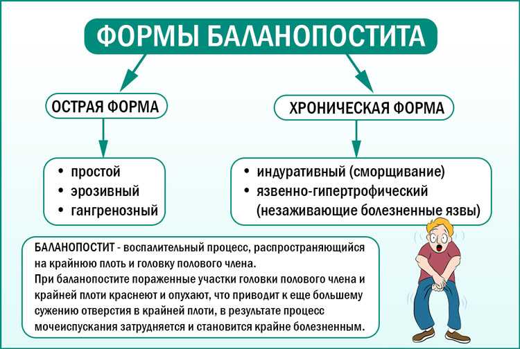 Баланопостит у мужчин схема лечения